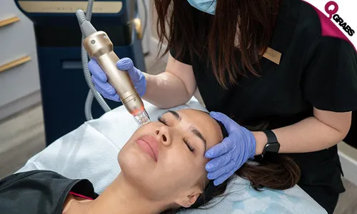 RF Microneedling Sessions!
